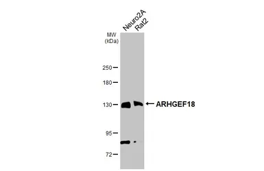 Anti-ARHGEF18 antibody [GT1972] used in Western Blot (WB). GTX629806