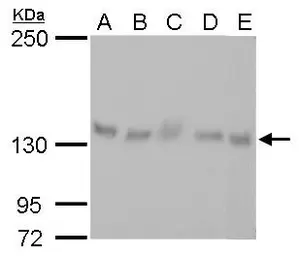 Anti-ARHGEF18 antibody [GT1972] used in Western Blot (WB). GTX629806