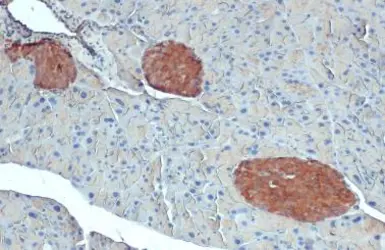 Anti-O-GlcNAc transferase antibody [GT678] used in IHC (Paraffin sections) (IHC-P). GTX629812