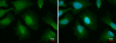 Anti-O-GlcNAc transferase antibody [GT678] used in Immunocytochemistry/ Immunofluorescence (ICC/IF). GTX629812