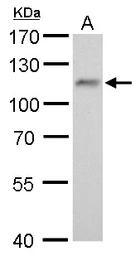 Anti-O-GlcNAc transferase antibody [GT678] used in Western Blot (WB). GTX629812