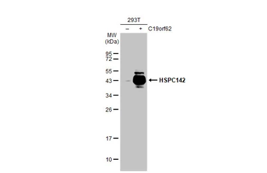 Anti-HSPC142 antibody [GT1251] used in Western Blot (WB). GTX629814
