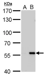 Anti-Carbonic Anhydrase IX antibody [GT546] used in Western Blot (WB). GTX629820