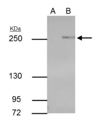 Anti-TET2 antibody [GT442] used in Immunoprecipitation (IP). GTX629880