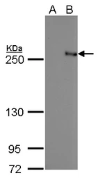 Anti-TET2 antibody [GT442] used in Western Blot (WB). GTX629880