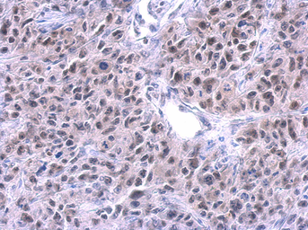 Anti-PUF60 antibody [GT3510] used in IHC (Paraffin sections) (IHC-P). GTX629885