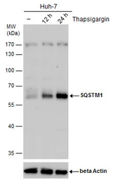 Anti-SQSTM1 / P62 antibody [GT239] used in Western Blot (WB). GTX629888