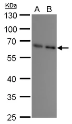Anti-SQSTM1 / P62 antibody [GT239] used in Western Blot (WB). GTX629888