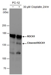 Anti-ROCK1 + ROCK2 antibody [GT261] used in Western Blot (WB). GTX629971