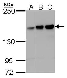 Anti-ROCK1 + ROCK2 antibody [GT261] used in Western Blot (WB). GTX629971
