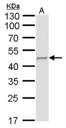 Anti-Fumarate hydratase antibody [GT548] used in Western Blot (WB). GTX630145