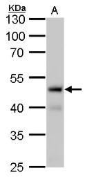 Anti-Fumarate hydratase antibody [GT7612] used in Western Blot (WB). GTX630146