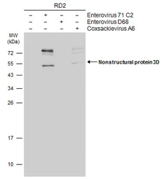 Anti-Enterovirus 71 3D antibody [4] used in Western Blot (WB). GTX630193