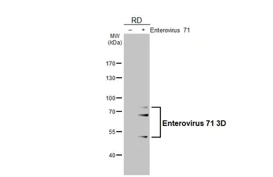 Anti-Enterovirus 71 3D antibody [4] used in Western Blot (WB). GTX630193