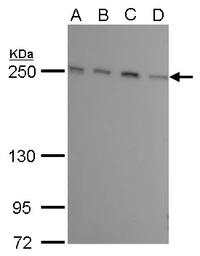 Anti-mTOR antibody [GT6611] used in Western Blot (WB). GTX630199