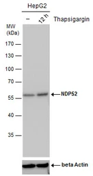 Anti-NDP52 antibody [GT422] used in Western Blot (WB). GTX630396