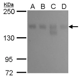 Anti-KDM6A antibody [GT1612] used in Western Blot (WB). GTX630412