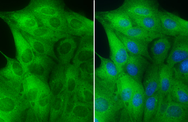 Anti-MEK1 + MEK2 antibody [GT1721] used in Immunocytochemistry/ Immunofluorescence (ICC/IF). GTX630542