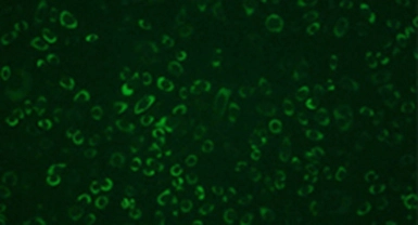 Anti-Dengue virus NS1 protein antibody [GT4212] used in Immunocytochemistry/ Immunofluorescence (ICC/IF). GTX630556