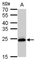 Anti-SOD2 antibody [GT582] used in Western Blot (WB). GTX630558