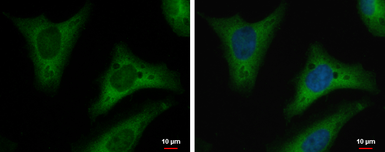 Anti-Triosephosphate isomerase antibody [GT181] used in Immunocytochemistry/ Immunofluorescence (ICC/IF). GTX630779