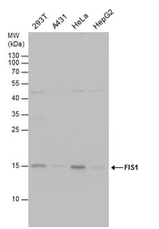 Anti-FIS1 antibody [GT4211] used in Western Blot (WB). GTX630983