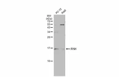Anti-FIS1 antibody [GT4211] used in Western Blot (WB). GTX630983