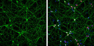 Anti-beta Tubulin 3/ Tuj1 antibody [GT886] used in Immunocytochemistry/ Immunofluorescence (ICC/IF). GTX631830
