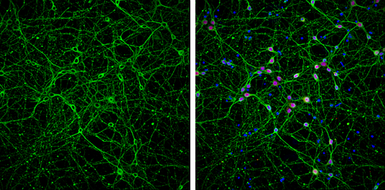Anti-beta Tubulin 3/ Tuj1 antibody [GT1338] used in Immunocytochemistry/ Immunofluorescence (ICC/IF). GTX631831