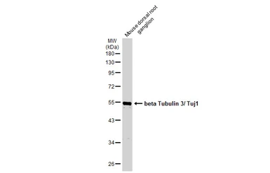 Anti-beta Tubulin 3/ Tuj1 antibody [GT11710] used in Western Blot (WB). GTX631836