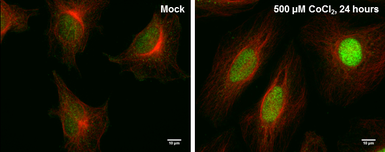 Anti-HIF2 alpha antibody [GT1689] used in Immunocytochemistry/ Immunofluorescence (ICC/IF). GTX632016
