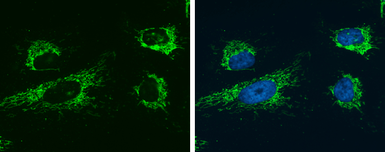 Anti-Glutaminase C (GAC) antibody [GT1075] used in Immunocytochemistry/ Immunofluorescence (ICC/IF). GTX632265