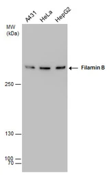 Anti-Filamin B antibody [GT387] used in Western Blot (WB). GTX632425