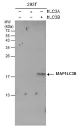 Anti-LC3B antibody [GT3612] used in Western Blot (WB). GTX632501