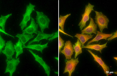Anti-CXCL16 antibody [GT516] used in Immunocytochemistry/ Immunofluorescence (ICC/IF). GTX632502