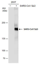 Anti-SARS-CoV Spike (SΔ3) antibody [7G12] used in Western Blot (WB). GTX632603