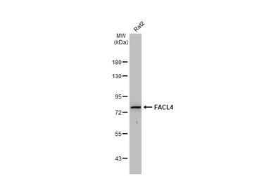 Anti-FACL4 antibody [GT566] used in Western Blot (WB). GTX632675