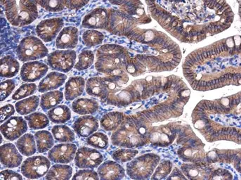 Anti-beta Catenin antibody [GT3171] used in IHC (Paraffin sections) (IHC-P). GTX632676