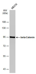 Anti-beta Catenin antibody [GT3171] used in Western Blot (WB). GTX632676