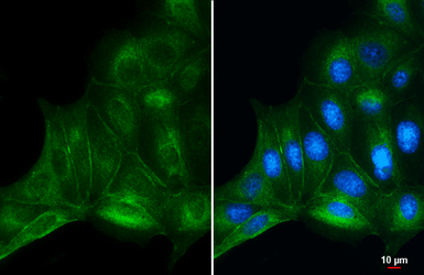 Anti-beta Catenin antibody [GT3171] used in Immunocytochemistry/ Immunofluorescence (ICC/IF). GTX632676