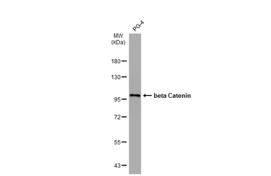 Anti-beta Catenin antibody [GT3171] used in Western Blot (WB). GTX632676