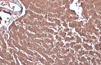 Anti-beta Catenin antibody [GT3171] used in IHC (Paraffin sections) (IHC-P). GTX632676