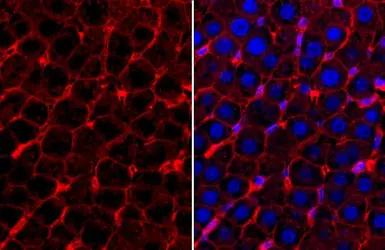 Anti-beta Catenin antibody [GT3171] used in IHC (Paraffin sections) (IHC-P). GTX632676