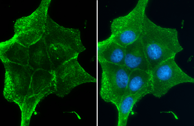 Anti-beta Catenin antibody [GT2169] used in Immunocytochemistry/ Immunofluorescence (ICC/IF). GTX633010