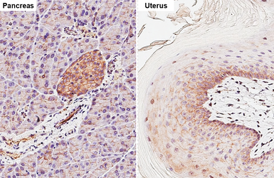 Anti-beta Catenin antibody [GT2169] used in IHC (Paraffin sections) (IHC-P). GTX633010