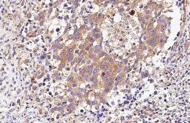 Anti-MYH9 antibody [GT218] used in IHC (Paraffin sections) (IHC-P). GTX633295