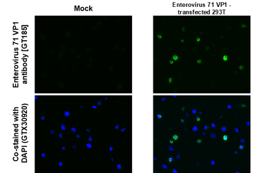 Anti-Enterovirus 71 VP1 antibody [GT185] used in IHC-P (cell pellet) (IHC-P (cell pellet)). GTX633390