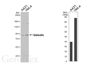 Anti-Gelsolin antibody [GT667] used in Western Blot (WB). GTX633675