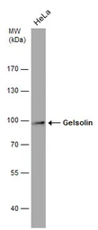 Anti-Gelsolin antibody [GT1656] used in Western Blot (WB). GTX633690