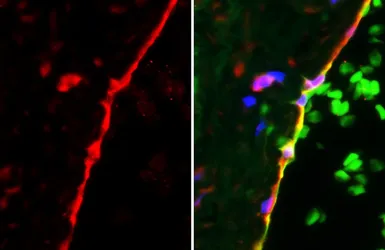 Anti-VE-Cadherin antibody [GT1369] used in IHC (Paraffin sections) (IHC-P). GTX633705